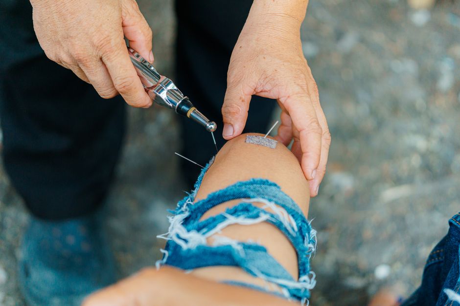 Licensed acupuncture discussion with an older adult